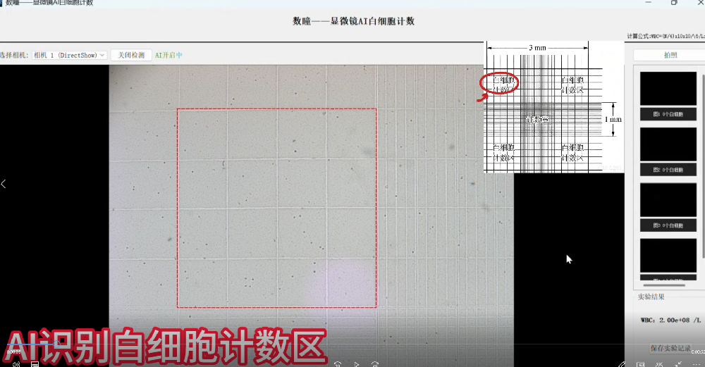 白细胞AI计数系统